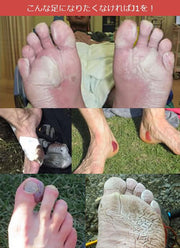 Protect J1 35ml Skin Protection Cream Shoe Blisters Rough Skin Blisters Beans Soggy